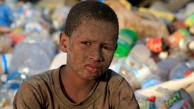 A boy from Yemen/Aljazeera.