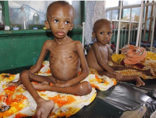 Food insecurity is having a dreadful impact on the world’s poorest/Aljazeera.