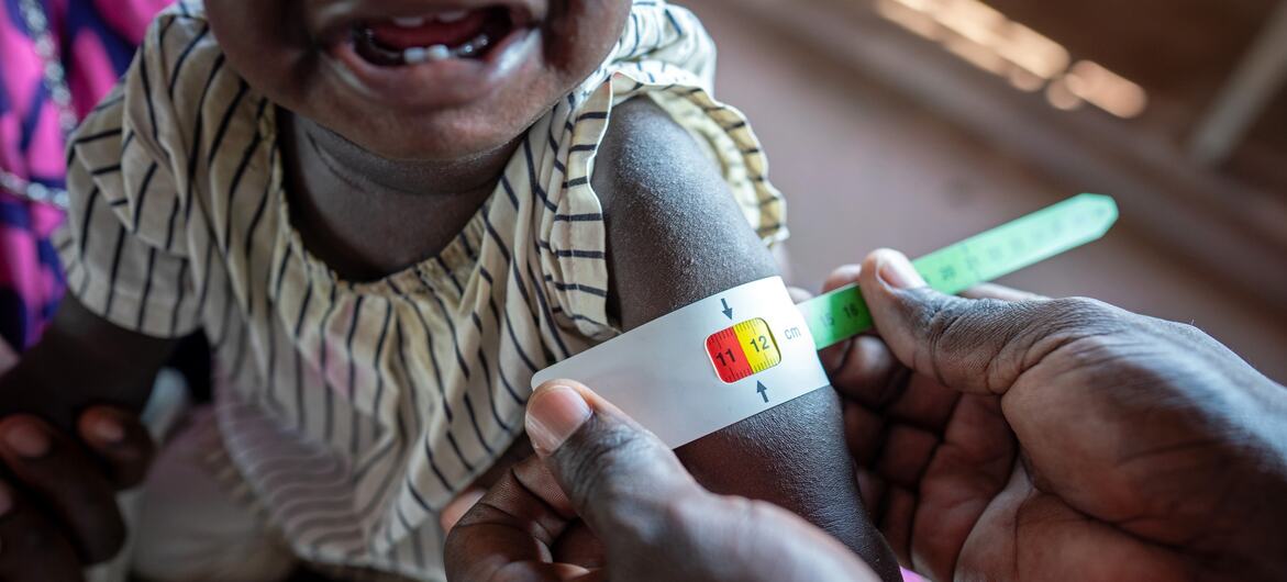© UNICEF/Mark Naftalin A health worker measures the arm circumference of a child, an indicator of malnutrition in children.