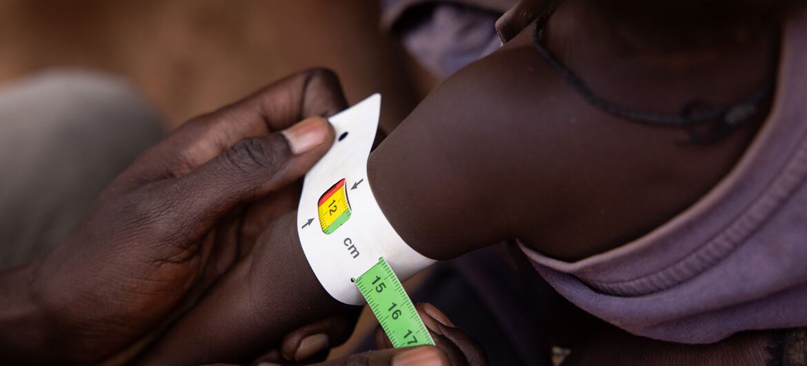 © WFP/Samantha Reinders A child in Aweil, South Sudan is checked for malnutrition